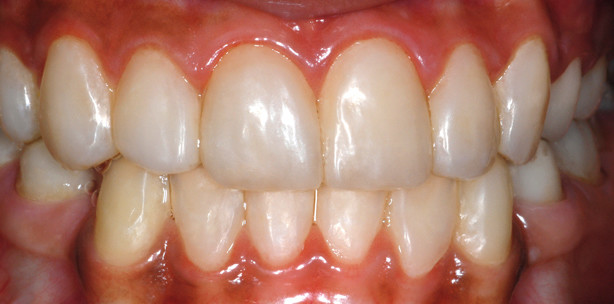 Direkt und indirekt erfolgreich kombiniert