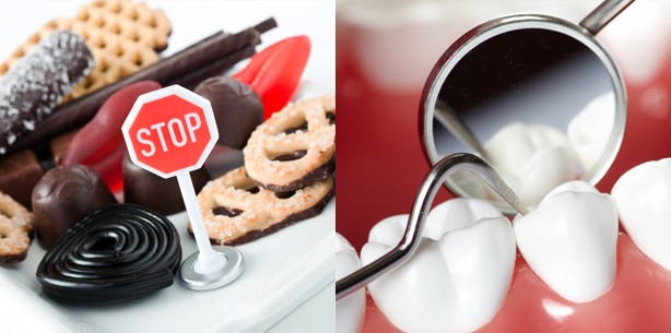 Übergewicht begünstigt Gingivitis