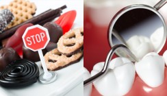 Übergewicht begünstigt Gingivitis