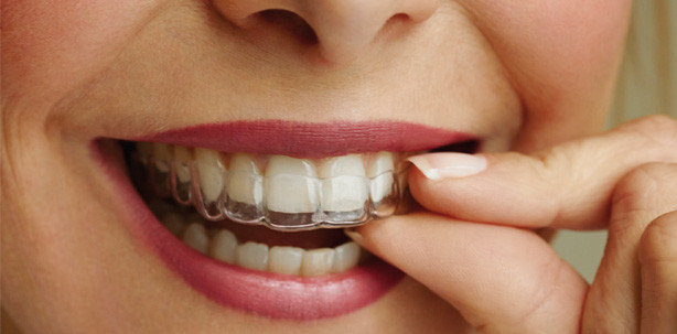 Neues aus der Ästhetischen Zahnheilkunde