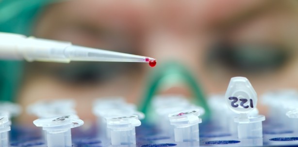 Aids-Experten hoffen auf Heilung in wenigen Jahren