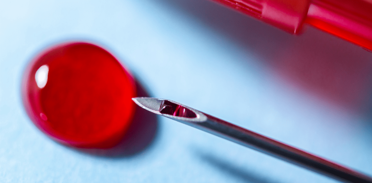 Keine Angst vor HIV, HBV und HCV in der Zahnarztpraxis