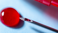 Keine Angst vor HIV, HBV und HCV in der Zahnarztpraxis