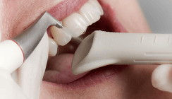 Air-Polishing – vom Power-Cleaning zum Biofilmmanagement