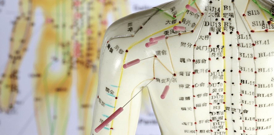 Akupunktur kann Hautkrankheiten deutlich lindern