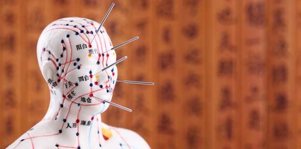 Heilende Nadelstiche – Akupunktur hat kaum Nebenwirkungen