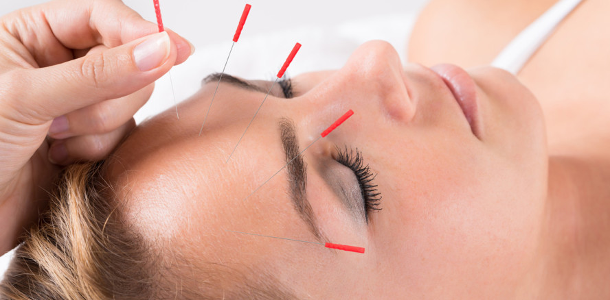 Mit Akupunktur gegen die Zahnarztangst