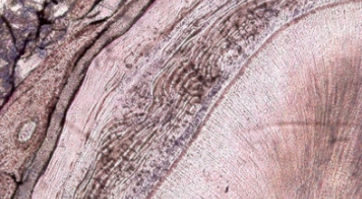 Zukunftsaufgabe: Alterndes Parodont