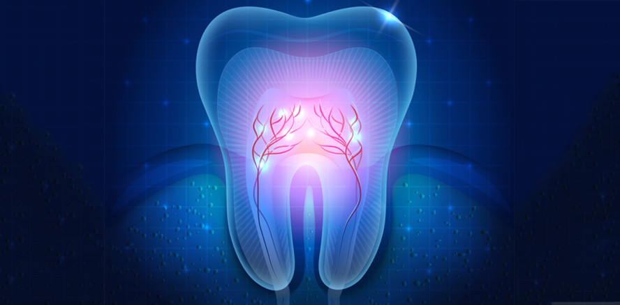 Alzheimer-Medikament verschließt Karieslöcher