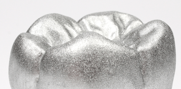 Füllungstherapie: Amalgam doch überlegen?