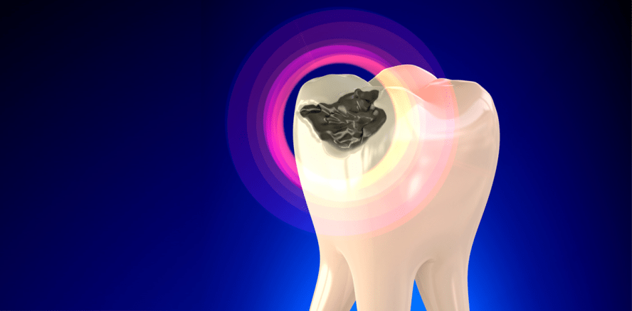 Zahnärztin durfte Patientin mit Amalgam versorgen
