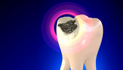 Zahnärztin durfte Patientin mit Amalgam versorgen