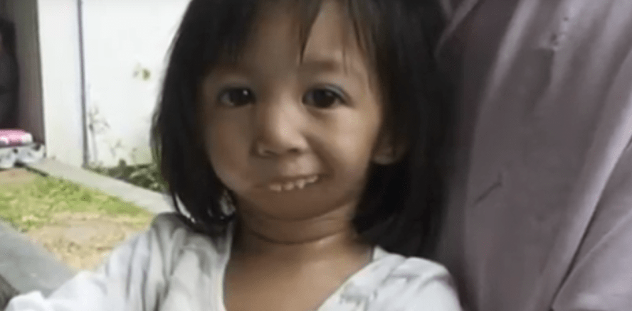 Nach OP: Mädchen kann erstmals Mund öffnen