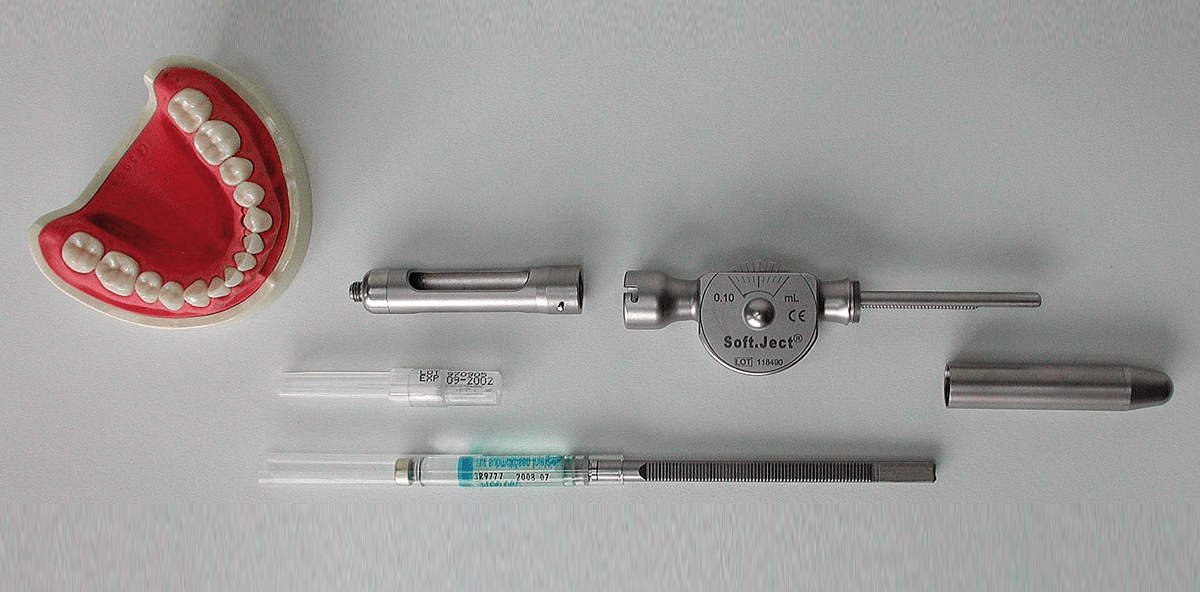 Die Substitution der Leitungsanästhesie