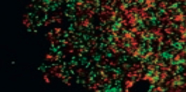 Antibakterielle Effekte ohne Eingriff in das ökologische Gleichgewicht der Mundhöhle