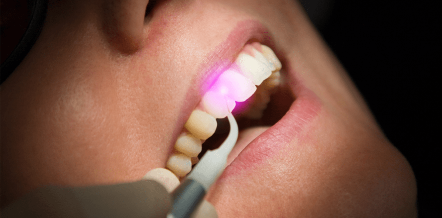 Photodynamische Therapie: Gericht bestätigt Analogberechnung