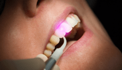 Photodynamische Therapie: Gericht bestätigt Analogberechnung