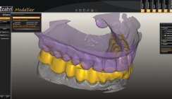 Apnoeschienen digital herstellen mittels CAD/CAM