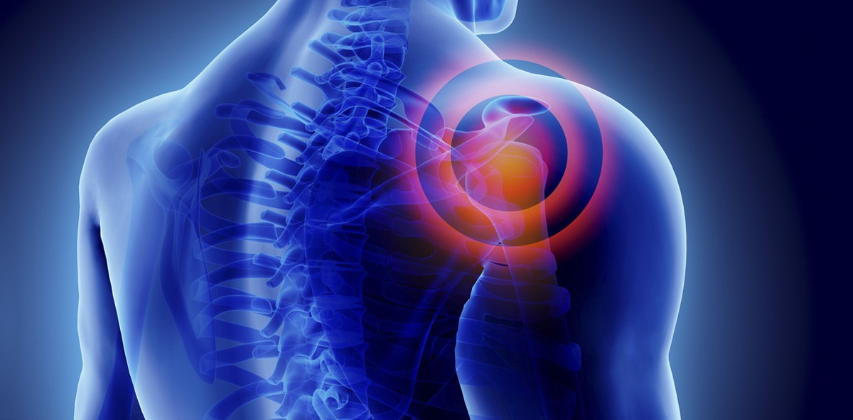 Zahnfleischentzündungen begünstigen Arthritis