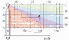 Die Artikulatorprogrammierung mit dem Vector-Analyzer