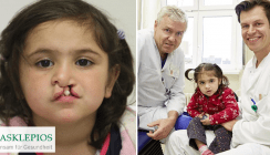 „Operation Lächeln“: Asklepios Klinik beseitigt Gesichtsfehlbildung