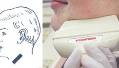 Ultraschallverfahren in der zahnärztlich-oralchirurgischen Diagnostik