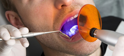 Moderne Bondingsysteme: Wo stehen wir heute?