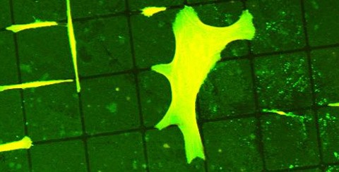 Die "Laster" der Zellen für bessere Implantate nutzen