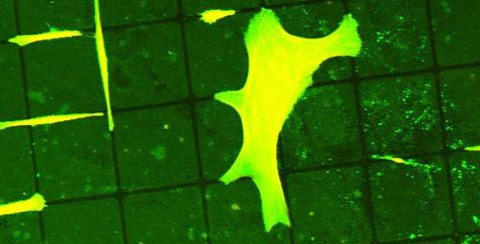 Die "Laster" der Zellen für bessere Implantate nutzen