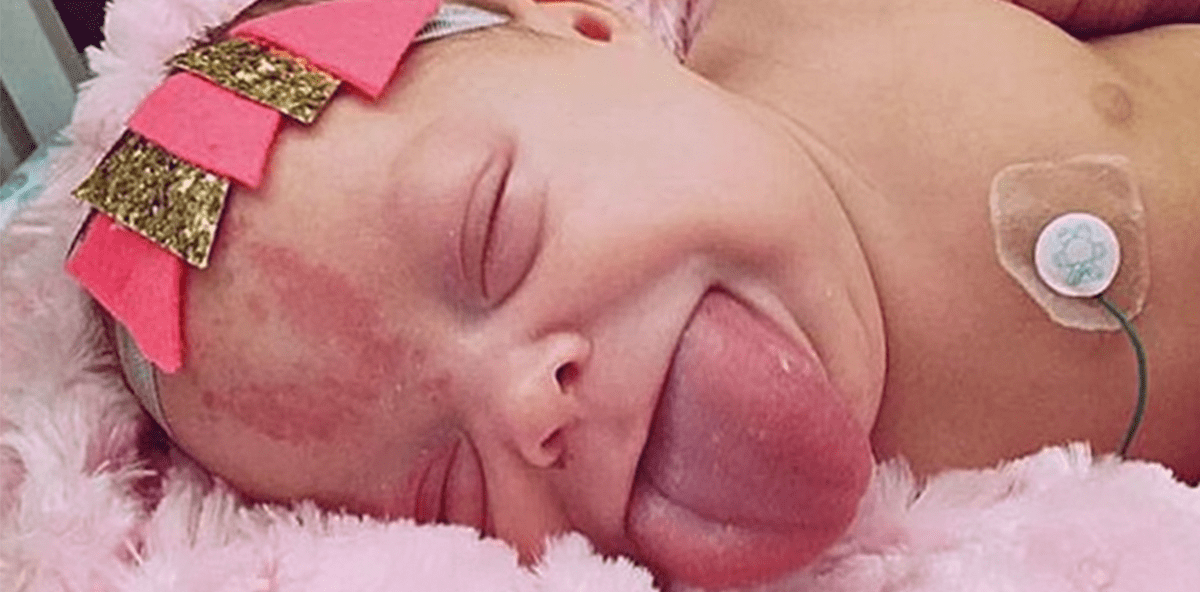 Riesenzunge: Baby Paisley kann endlich wieder lachen