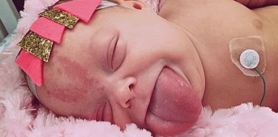 Riesenzunge: Baby Paisley kann endlich wieder lachen