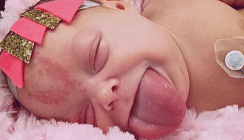 Riesenzunge: Baby Paisley kann endlich wieder lachen