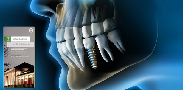 Konzepte bei stark reduziertem Knochenangebot