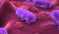 Studie zu Gingivitis: Bakterien manipulieren das Immunsystem