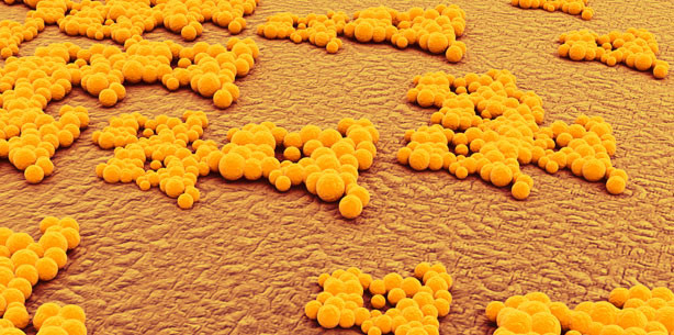 Kohlendioxid und Silberpartikel für bakterienfreie Oberflächen