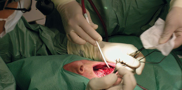 Rolle der Pflege und Stärkung fragiler Schutzbarrieren