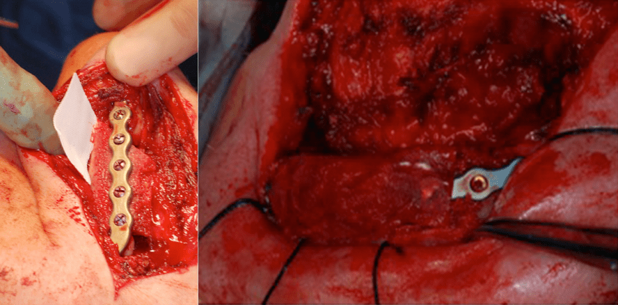 Barrieremembran – ein urzeitlicher Dinosaurier vom Aussterben bedroht?