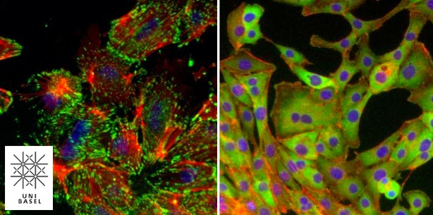 Basler Forscher entdecken wichtigen Schaltkreis bei Krebsmetastasen
