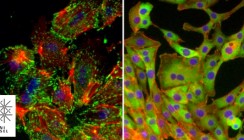 Basler Forscher entdecken wichtigen Schaltkreis bei Krebsmetastasen