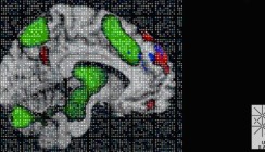 Basler Forscher entdecken Gedächtnismolekül