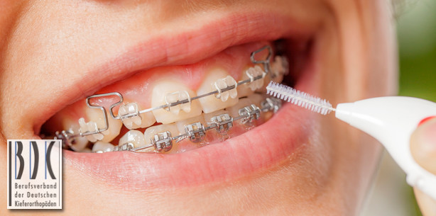 Schule, Zähneputzen – und die „Spangen“