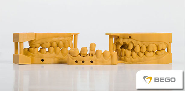 Zahntechnische Modelle mit dem BEGO Varseo 3D-Drucker herstellen