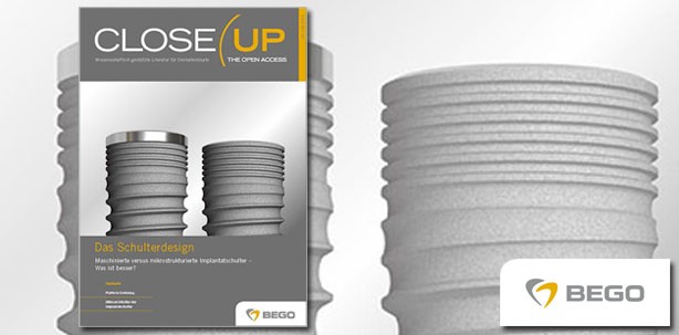 BEGO Implant Systems veröffentlicht neue Ausgabe von Close Up