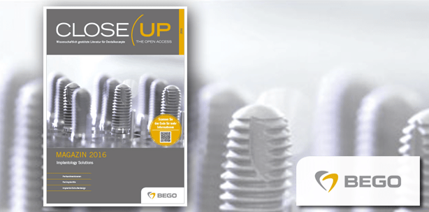 Ein Konzept geht auf: Close Up – The Open Access