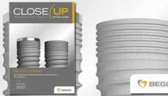 BEGO Implant Systems veröffentlicht neue Ausgabe von Close Up