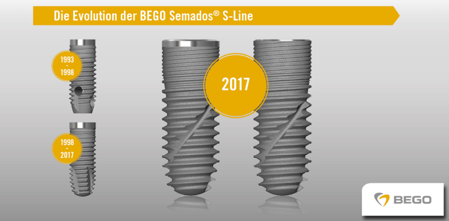 Die Evolution der S-Line – BEGO Semados® SC/SCX-Implantate