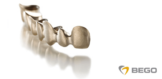 BEGO erweitert CAD/Cast®-Verfahren um acht weitere Legierungen