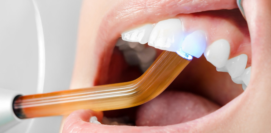 Schmerzfreie Kariesbehandlung mit Harz