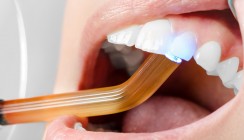 Schmerzfreie Kariesbehandlung mit Harz