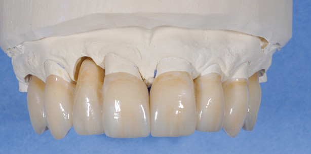 Freude in der Zahntechnik